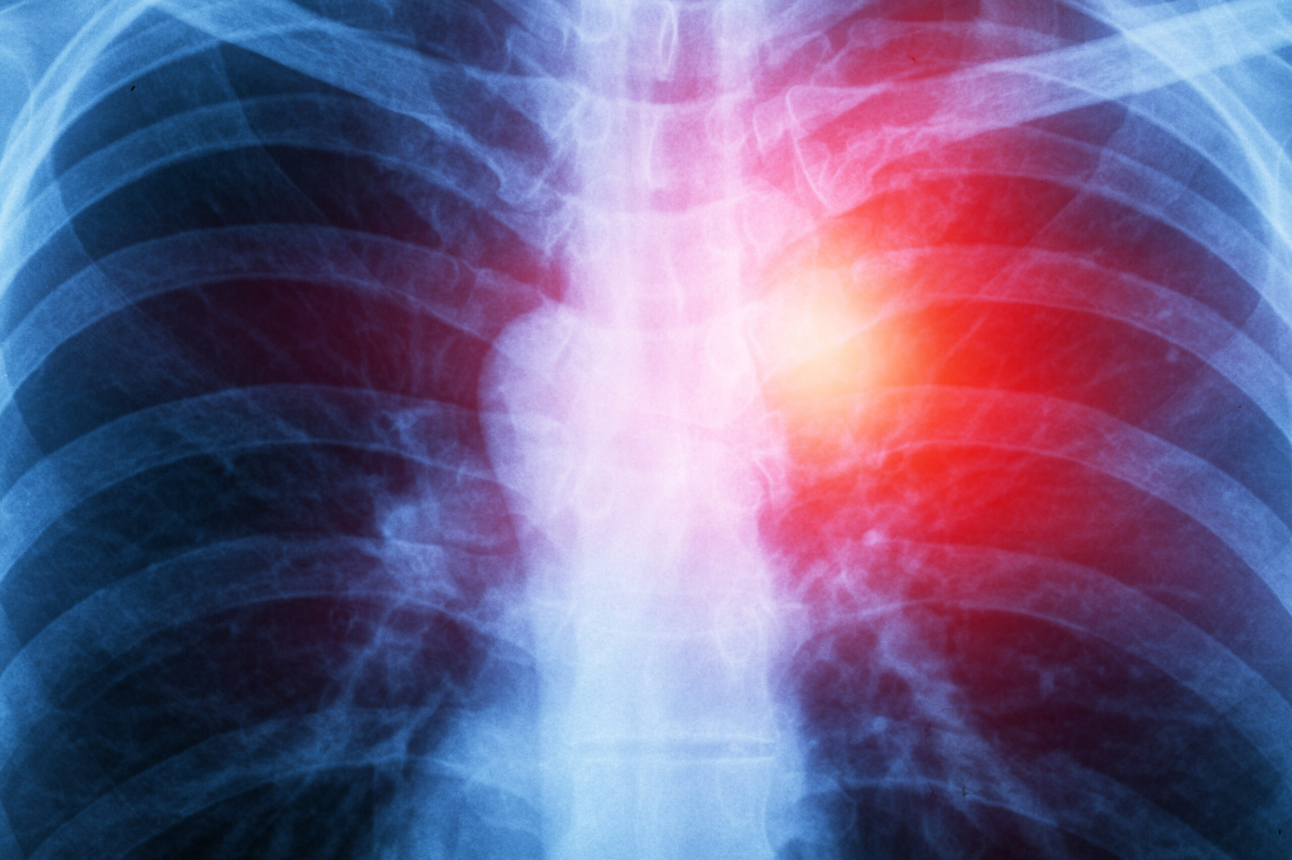 Medical,Digital,Human,Chest,X-ray